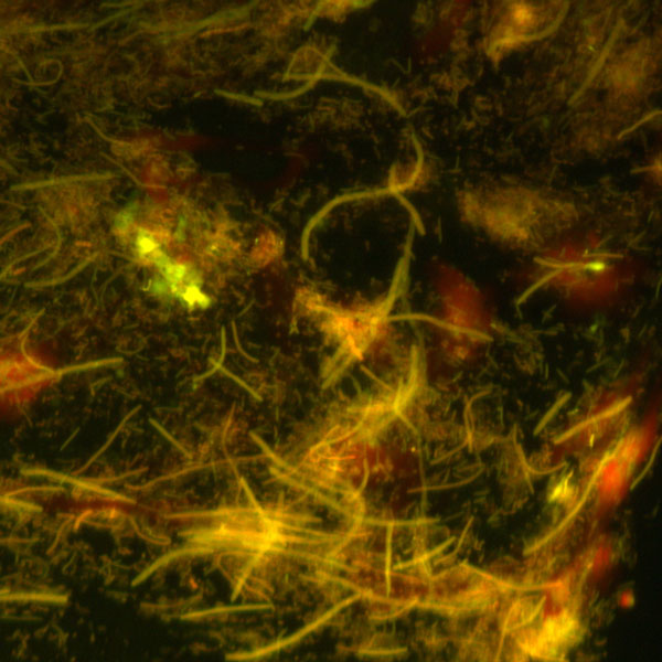 Visone al microscopio