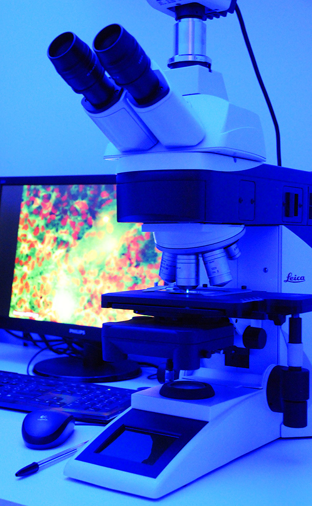 Microscopio a epifluorescenza