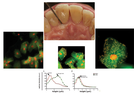 Numerose cellule epiteliali con morfologia intatta, possibilità di trovare cocchi all'interno e all'esterno delle cellule. Fase di guarigione clinica e citologica